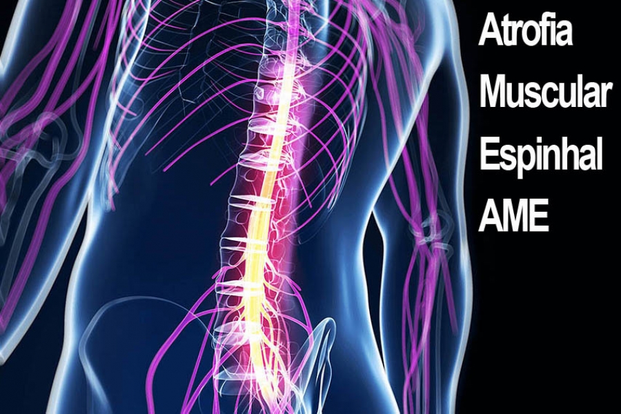 Mitos e verdades sobre a atrofia muscular espinhal