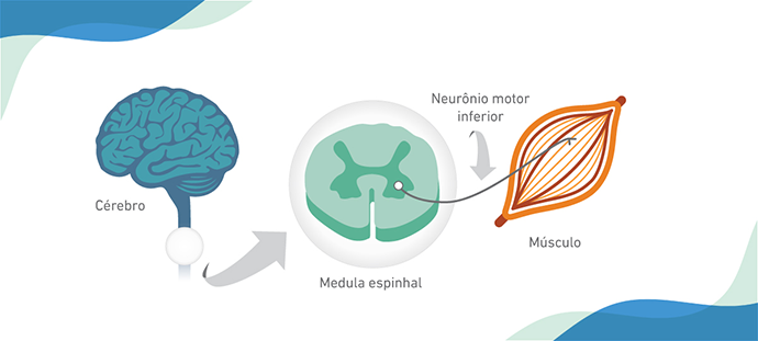 Instituto Jô Clemente (IJC) lança Guia de Orientação para Diagnóstico, Seguimento e Tratamento da AME-5q (Atrofia Muscular Espinhal 5q) 