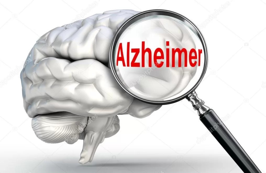 Especialistas discutem doença de Alzheimer em podcast  