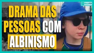 Albinismo: famílias enfrentam falta de apoio