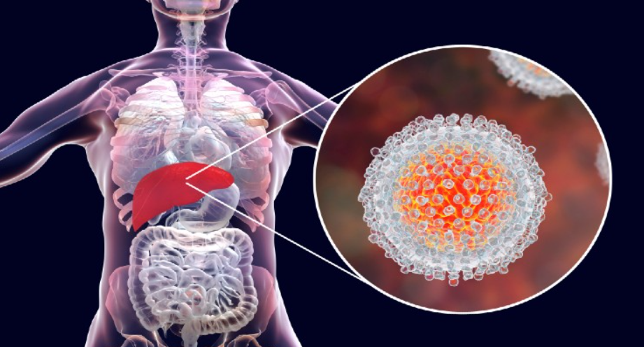 Julho Amarelo: novo teste ajuda a reduzir em quatro semanas diagnóstico de hepatite C