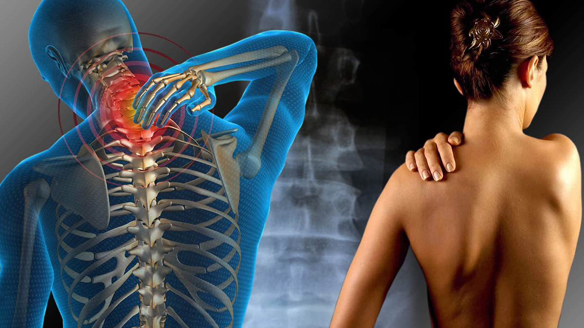 Fibromialgia, uma síndrome crônica que vai além da dor no VideBula