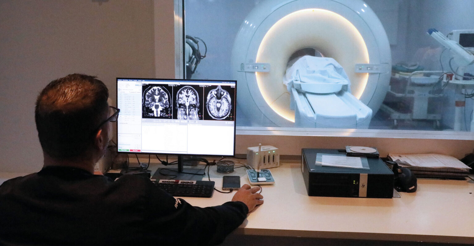 Epilepsia: linha de pesquisa busca novas formas de tratamento e prevenção