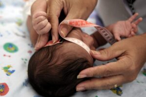 Geração Zika: 10 anos depois, os desafios das crianças afetadas pela microcefalia