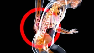 Fibromialgia e Pessoa com Deficiência: quando a dor invisível passa a ser reconhecida como direito - OPINIÃO - * Por Igor Lima