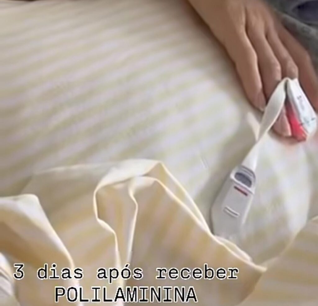 Paulista com lesão na medula volta a mexer braço após receber polilaminina em cirurgia determinada pelo Judiciário