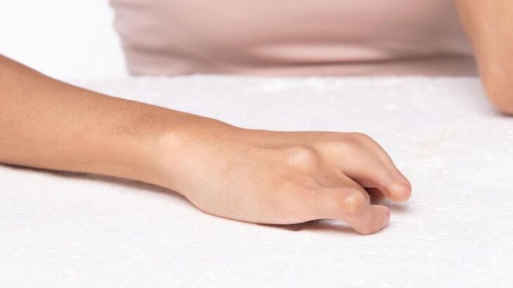 TRF3 confirma revisão de pensão especial e indenização a pessoa com síndrome da talidomida