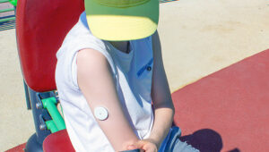 Estudos alertam sobre problemas de pele em crianças e adolescentes que utilizam dispositivos para controlar diabetes
