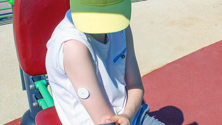 Estudos alertam sobre problemas de pele em crianças e adolescentes que utilizam dispositivos para controlar diabetes