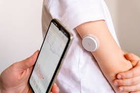 Pesquisa mundial alerta sobre problemas de pele em crianças e adolescentes que utilizam dispositivos para controlar diabetes