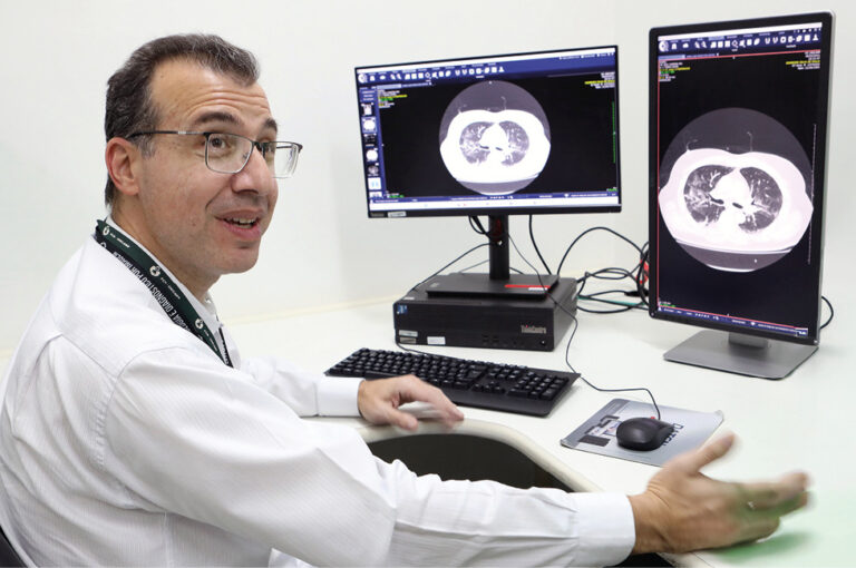 Especialistas anunciam software que mapeia lobos pulmonares em doenças graves