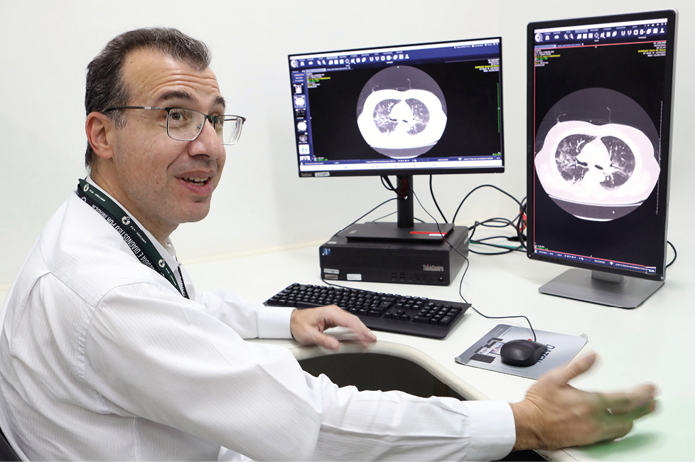Especialistas anunciam software que mapeia lobos pulmonares em doenças graves