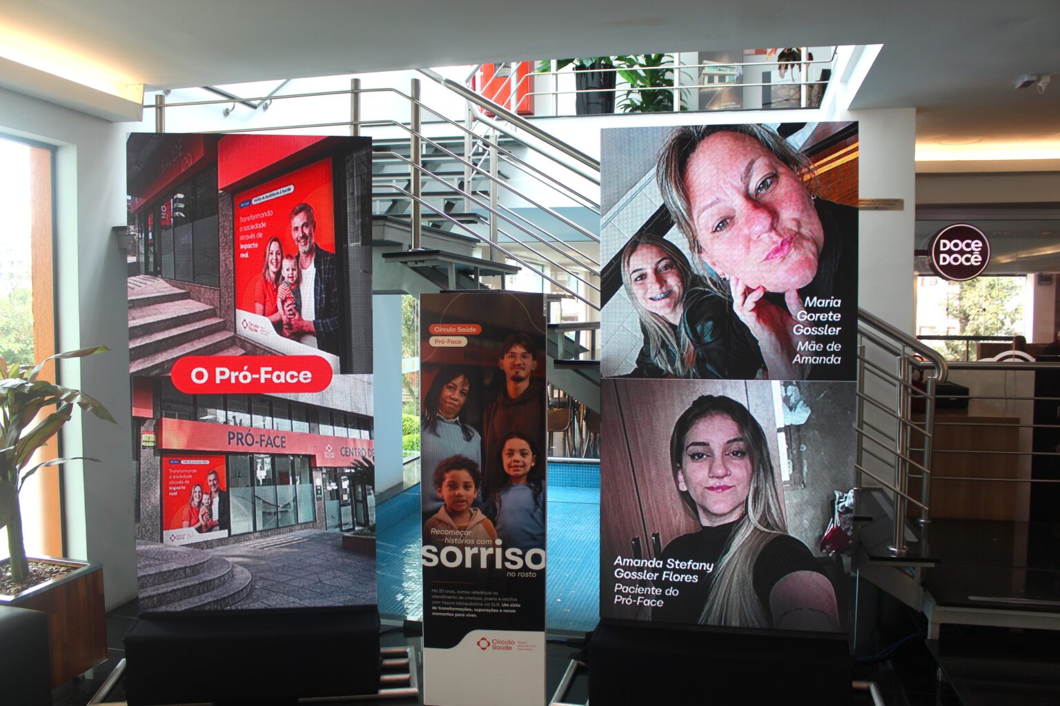 Exposição no RS reúne histórias de pacientes atendidos gratuitamente por serviço especializado em fissura labiopalatina