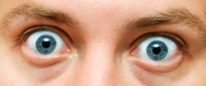 Campanha sobre a Doença Ocular da Tireoide alerta para as dificuldades de acesso e diagnóstico ao tratamento