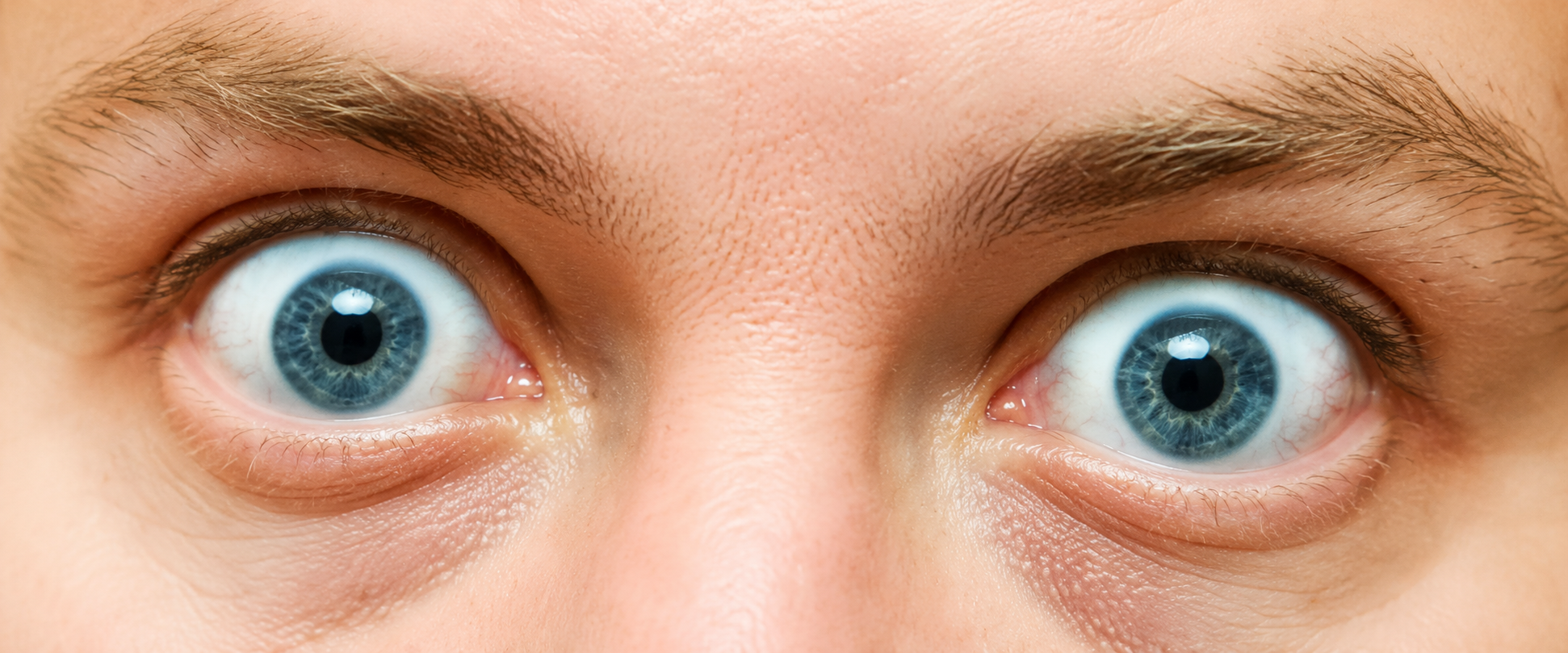 Campanha sobre a Doença Ocular da Tireoide alerta para as dificuldades de acesso e diagnóstico ao tratamento